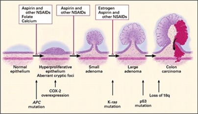 An Inducible Mouse Model of Colon Carcinogenesis | Society for Mucosal ...